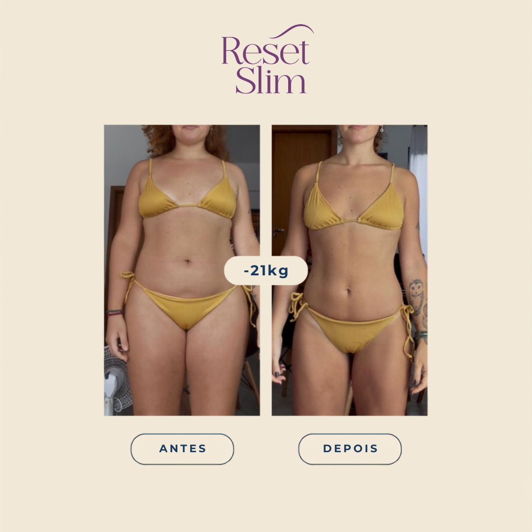 Resultado de paciente Reset Slim: −21 kg, antes e depois