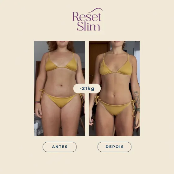 Resultado de paciente Reset Slim: −21 kg, antes e depois