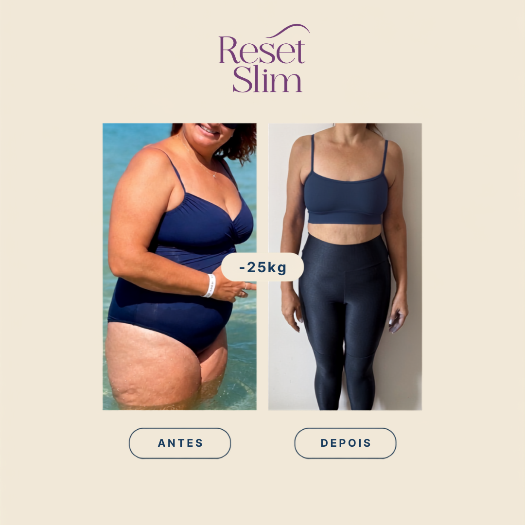 Resultado de paciente Reset Slim: −25 kg, antes e depois