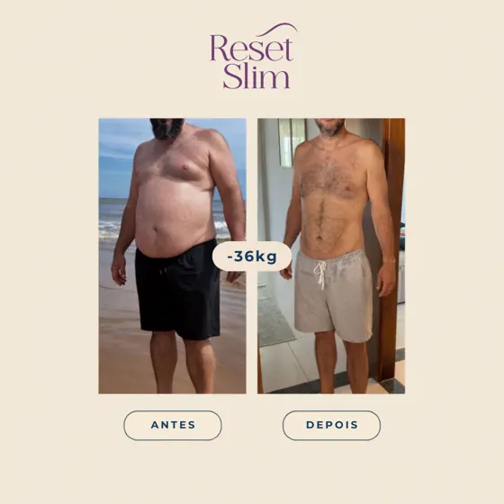 Resultado de paciente Reset Slim: −36 kg, antes e depois