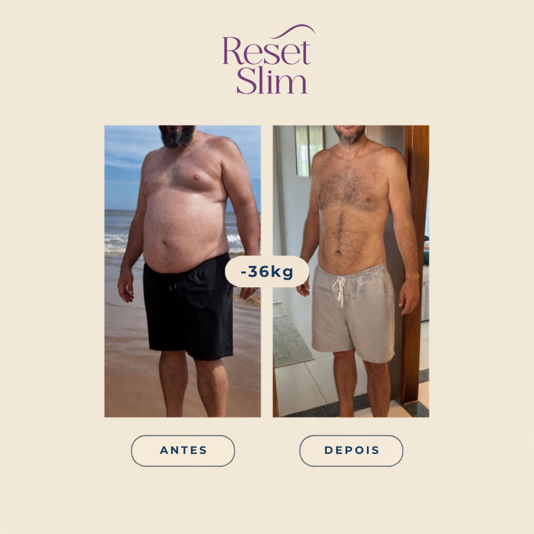 Resultado de paciente Reset Slim: −36 kg, antes e depois